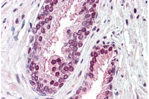 Anti-CDCP1 antibody  ABIN960755 IHC staining of human prostate. (CDCP1 antibody  (Internal Region))