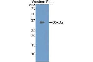 Detection of Recombinant LOX1, Rat using Polyclonal Antibody to Lectin Like Oxidized Low Density Lipoprotein Receptor 1 (LOX1) (OLR1 antibody  (AA 51-314))