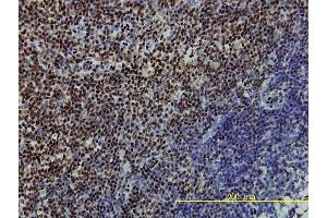 Immunoperoxidase of monoclonal antibody to SSB on formalin-fixed paraffin-embedded human tonsil tissue. (SSB antibody  (AA 1-408))