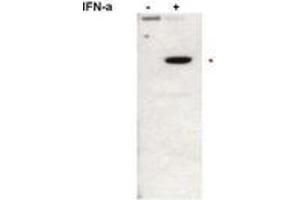 Image no. 1 for anti-Signal Transducer and Activator of Transcription 2, 113kDa (STAT2) (pTyr690) antibody (ABIN291118)