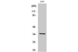 Western Blotting (WB) image for anti-Carbonic Anhydrase VA (CA5A) (Internal Region) antibody (ABIN3183596)