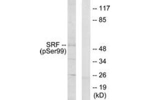 Western blot analysis of extracts from LOVO cells treated with Serum 10% 15', using SRF (Phospho-Ser99) Antibody. (SRF antibody  (pSer103))
