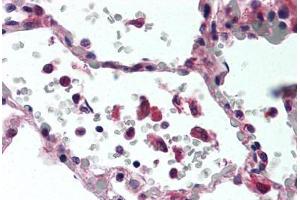 Human Lung (formalin-fixed, paraffin-embedded) stained with TNF antibody ABIN305730 at 2. (TNF alpha antibody)