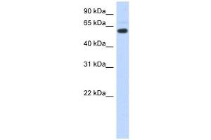 CDYL antibody used at 1 ug/ml to detect target protein. (CDYL antibody  (N-Term))