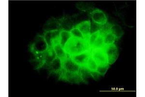 Immunofluorescence of monoclonal antibody to DNAI2 on A-431 cell. (DNAI2 antibody  (AA 1-593))