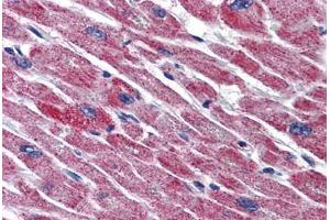 Human Heart: Formalin-Fixed, Paraffin-Embedded (FFPE) (DLD antibody  (AA 1-510))