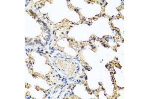Immunohistochemistry of paraffin-embedded rat lung using PIP antibody at dilution of 1:100 (40x lens). (PIP antibody)
