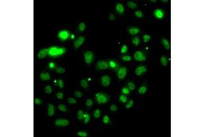 Immunofluorescence analysis of U2OS cells using PMS2 antibody. (PMS2 antibody)