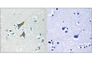 Immunohistochemistry analysis of paraffin-embedded human brain tissue, using MKP1 (Ab-359) Antibody. (DUSP1 antibody  (AA 318-367))