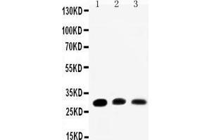 Anti-Aquaporin 1 antibody, Western blotting Lane 1: Rat Kidney Tissue Lysate Lane 2: Rat Lung Tissue Lysate Lane 3: SMMC Cell Lysate (Aquaporin 1 antibody  (C-Term))