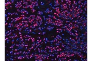 IF analysis of UBC12/UBE2M using anti-UBC12/UBE2M antibody (ABIN7600885).