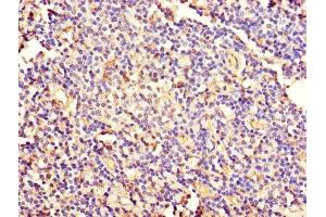 Immunohistochemistry of paraffin-embedded human tonsil tissue using ABIN7157424 at dilution of 1:100 (KRT4 antibody  (AA 1-534))