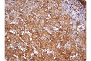 Image no. 2 for anti-Proteasome Subunit alpha 2 (PSMA2) (AA 50-234) antibody (ABIN1491566) (PSMA2 antibody  (AA 50-234))