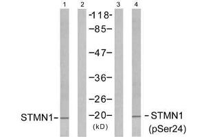 Western blot analysis of extracts from Jurkat cells untreated or treated with PMA (1ng/ml, 15min), using Stathmin 1 (Ab-24) antibody (E021217, Line 1 and 2) and Stathmin 1 (phospho-Ser24) antibody (E011224, Line 3 and 4). (Stathmin 1 antibody)