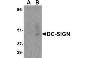 Western Blotting (WB) image for anti-CD209 (CD209) (Extracellular Domain) antibody (ABIN492510) (DC-SIGN/CD209 antibody  (Extracellular Domain))