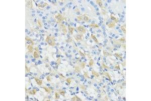 Immunohistochemistry (IHC) image for anti-Glutathione Peroxidase 2 (GPX2) (AA 100-180) antibody (ABIN7267435)