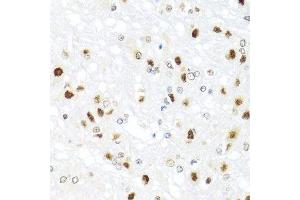 Immunohistochemistry of paraffin-embedded rat brain using GATA2 antibody. (GATA2 antibody  (AA 1-300))