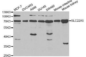 Western blot analysis of extracts of various cell lines, using SLC22A5 antibody. (SLC22A5 antibody  (AA 1-180))
