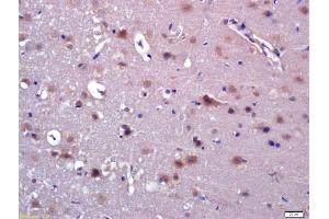 Formalin-fixed and paraffin embedded rat brain labeled with Anti-ABAT Polyclonal Antibody, Unconjugated (ABIN705641) at 1:200 followed by conjugation to the secondary antibody and DAB staining (ABAT antibody  (AA 151-250))
