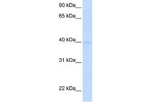 WB Suggested Anti-SLC25A36 Antibody Titration:  0. (SLC25A36 antibody  (N-Term))
