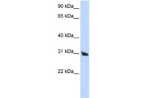 WB Suggested Anti-RNASE9 Antibody Titration:  0. (RNASE9 antibody  (N-Term))