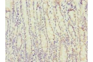 Immunohistochemistry of paraffin-embedded human small intestine tissue using ABIN7172730 at dilution of 1:100 (MTERFD3 antibody  (AA 1-250))