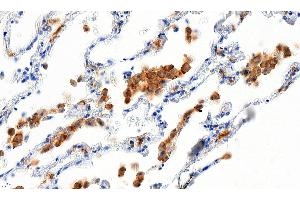 ABIN184738 (5µg/ml) staining of paraffin embedded Human Lung. (Iba1 antibody  (C-Term))