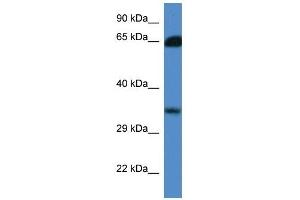 Western Blot showing MGC3207 antibody used at a concentration of 1. (MRI1 antibody  (N-Term))