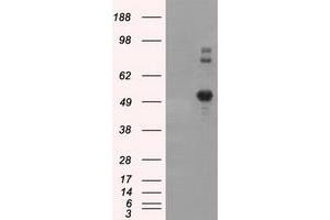 Image no. 8 for anti-Nucleotide Exchange Factor SIL1 (SIL1) antibody (ABIN1496810) (SIL1 antibody)