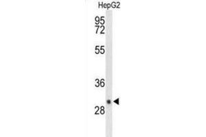 Western Blotting (WB) image for anti-Deiodinase, Iodothyronine, Type III (DIO3) antibody (ABIN3004215)