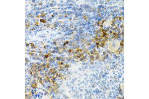 Immunohistochemistry of paraffin-embedded mouse spleen using SULT2A1 Antibody. (SULT2A1 antibody)