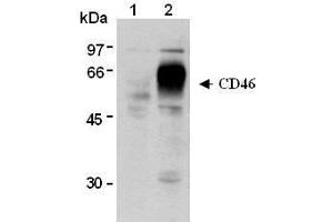 Western Blotting (WB) image for anti-CD46 (CD46) antibody (ABIN1449263) (CD46 antibody)