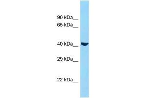 Host: Rabbit  Target Name: ADIPOR1  Sample Tissue: 293T cell lysates  Antibody Dilution: 1. (Adiponectin Receptor 1 antibody  (N-Term))