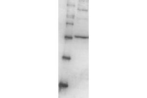 Western Blotting (WB) image for anti-Proteasome (Prosome, Macropain) 26S Subunit, Non-ATPase, 13 (PSMD13) (full length) antibody (ABIN2452116) (PSMD13 antibody  (full length))
