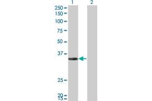 Western Blot analysis of ECH1 expression in transfected 293T cell line by ECH1 monoclonal antibody (M01), clone 5G8. (ECH1 antibody  (AA 21-120))