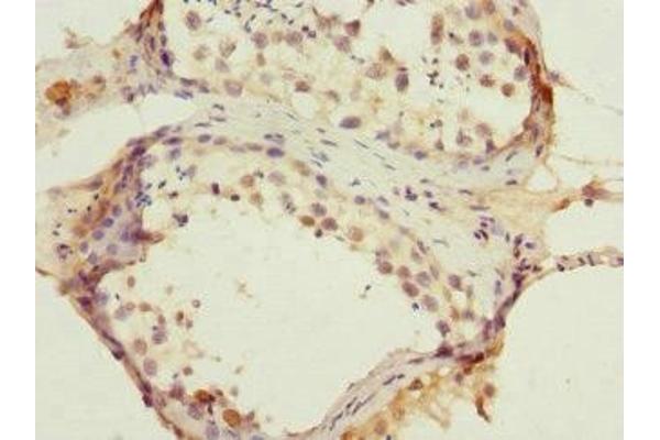 ANTXR2 antibody  (AA 340-489)