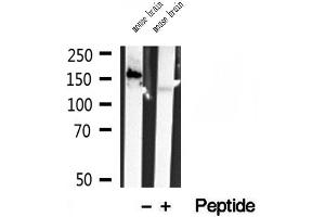 Western blot analysis of extracts of mouse brain tissue, using CAMSAP2 antibody. (CAMSAP2 antibody  (C-Term))