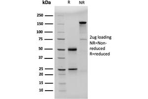 SDS-PAGE Analysis Purified CD23-Monospecific Mouse Monoclonal Antibody (FCER2/3592). (FCER2 antibody  (AA 48-321))