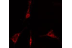 ABIN6275846 staining  293 cells by IF/ICC. (IRAK2 antibody  (Internal Region))