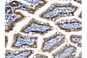 IHC analysis of CSNK2K2 using anti-CSNK2K2 antibody (ABIN7602871). (CSNK2A2 antibody  (C-Term))