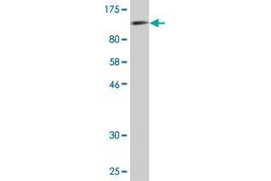 Western Blotting (WB) image for anti-Collagen, Type XIV, alpha 1 (COL14A1) (AA 1-759) antibody (ABIN521261)