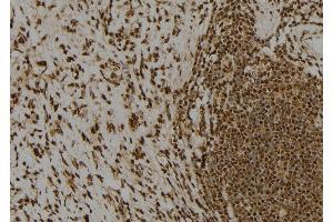 ABIN6260859 and ABIN6277738 at 1/100 staining Human gastric tissue by IHC-P.
