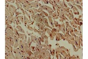 Immunohistochemistry of paraffin-embedded human heart tissue using ABIN7142988 at dilution of 1:100 (ASAH1 antibody  (AA 22-395))