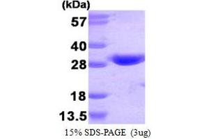 GSTT1 Protein (AA 1-240) (His tag)