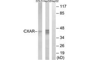 Western blot analysis of extracts from HepG2/COLO cells, using CXADR Antibody. (Coxsackie Adenovirus Receptor antibody  (AA 1-50))