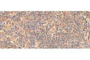 Immunohistochemistry of paraffin-embedded Human tonsil tissue using EIF3K Polyclonal Antibody at dilution of 1:55(x200) (EIF3K antibody)