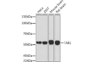 Western blot analysis of extracts of various cell lines, using T Rabbit mAb (ABIN1680832, ABIN7101518, ABIN7101519 and ABIN7101520) at 1:1000 dilution. (TAB1 antibody)