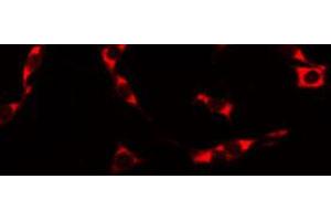 ABIN6274851 staining HuvEc by IF/ICC. (Anosmin antibody  (Internal Region))