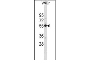 PSMD12 Antibody (Center) (ABIN1881697 and ABIN2838970) western blot analysis in WiDr cell line lysates (35 μg/lane). (PSMD12 antibody  (AA 276-304))