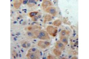 Used in DAB staining on fromalin fixed paraffin-embedded Liver tissue (Cathepsin S antibody  (AA 123-339))